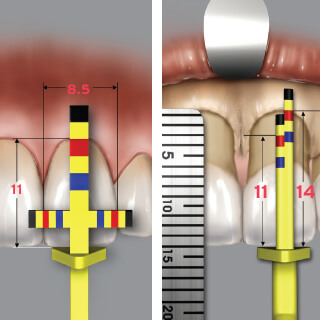 Aesthetic gauges