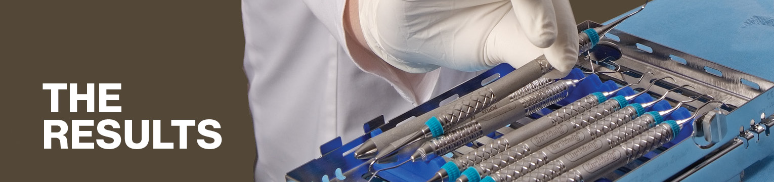 pacific dental services results