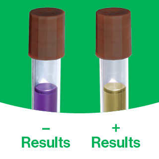 Biological monitoring results