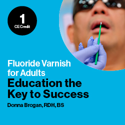 Fluoride Varnish For Adults: Education the Key to Success