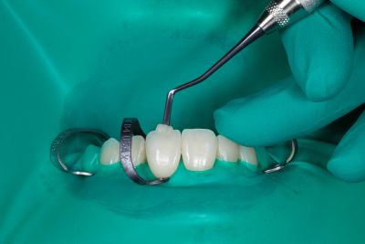 Dental Dam, Latex, Powder-Free/Low Protein, Green, Medium, Mint