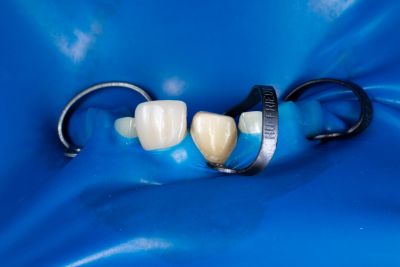 Dental Dam, Latex, Powder-Free/Low Protein, Blue, Heavy, Unflavored