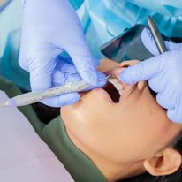 进行手工洁治器械